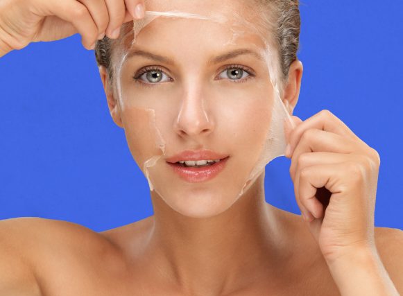 CHEMICAL-PEELS-001 CHEMICAL-PEELS-001