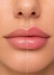 Russian Lips vs Classic Lip Filler in Reading Close-up lip comparison showing classic lip filler and Russian lips styles